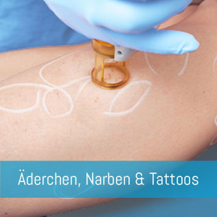 Couperose Narben Tattoos - Dr. René Kaplan