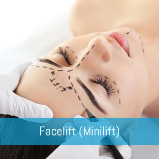 Facelift Minilift - Dr. René Kaplan