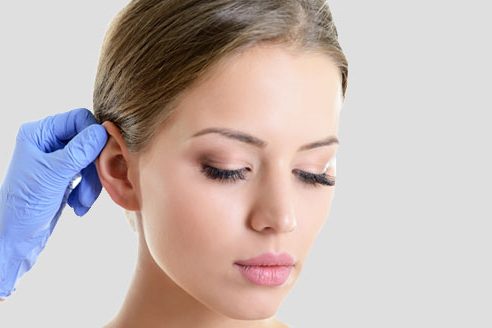 Ohrenkorrektur - Ohranlegeplastik
